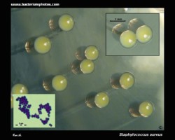 S.aureus yellow pigment staphyloxanthin and colony morphology of golden staph on triptic soy agar